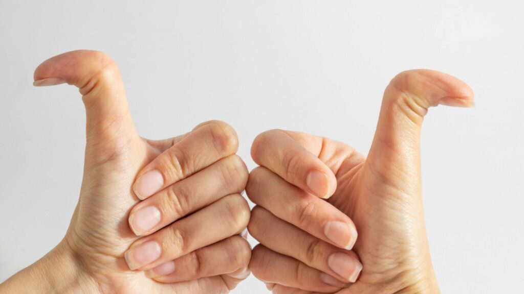 Hypermobility: a gift or a curse? Reveal the truth