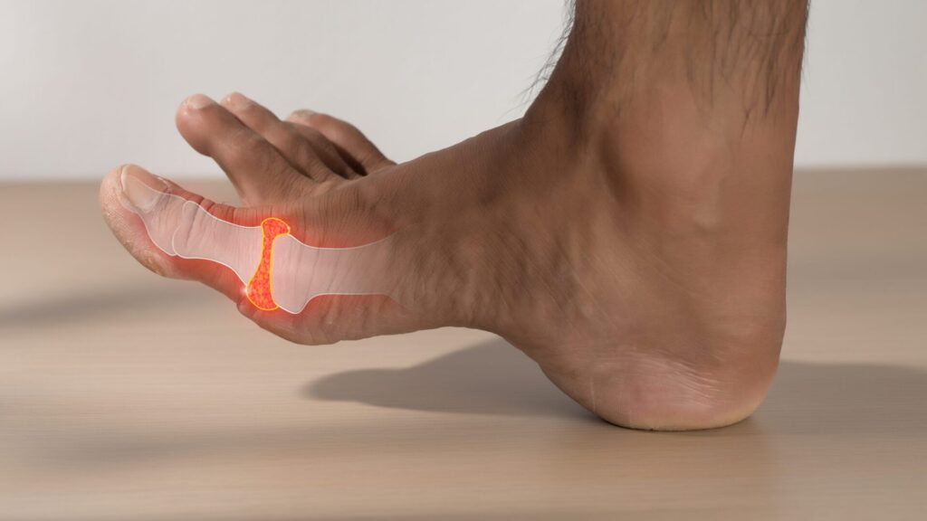 Thumb pain or other symptoms may indicate a more serious condition.