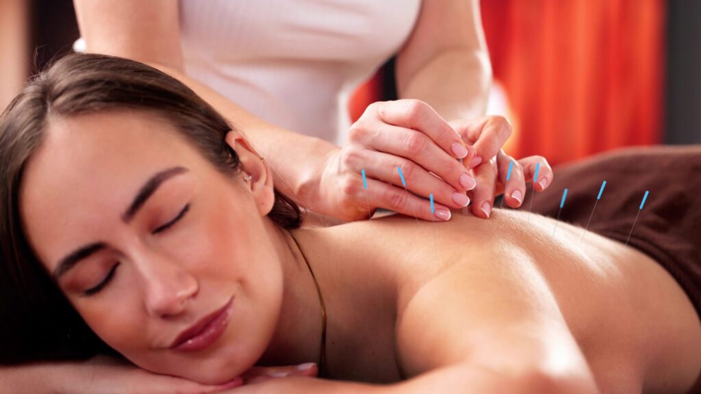 Acupuncture originated in ancient China.